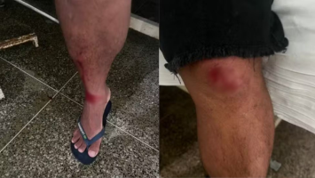 Homem é preso suspeito de agredir tio com golpes de pá após briga por benefício da avó no PI